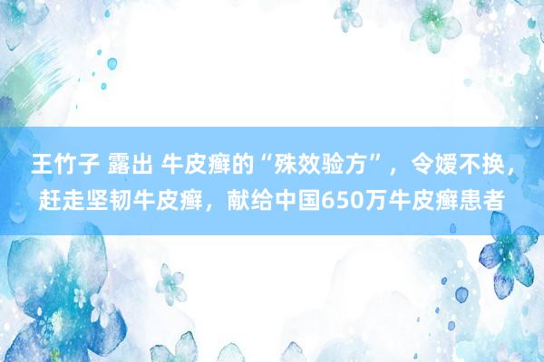 王竹子 露出 牛皮癣的“殊效验方”,令嫒不换,赶走坚韧牛皮癣,献给中国650万牛皮癣患者